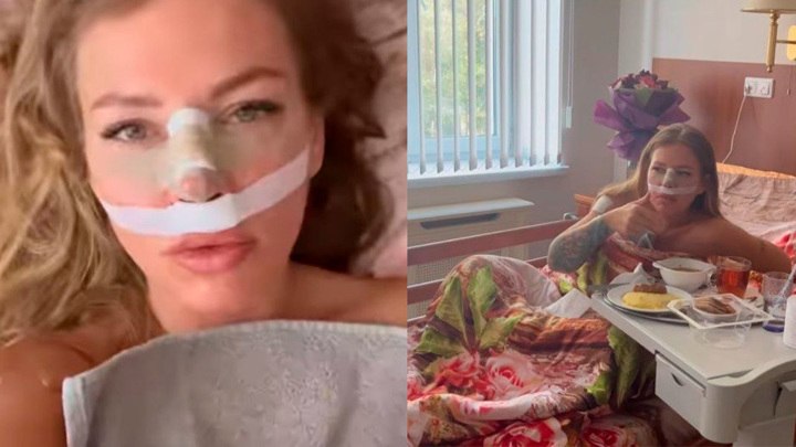 "Бесформенное месиво" на лице: Рита Дакота сделала операцию